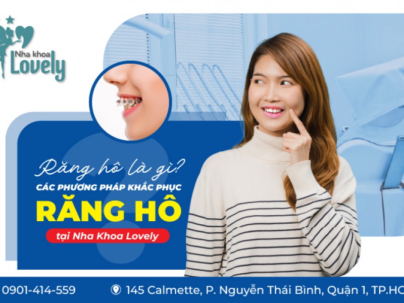 Răng hô là gì? Các phương pháp khắc phục tình trạng răng hô