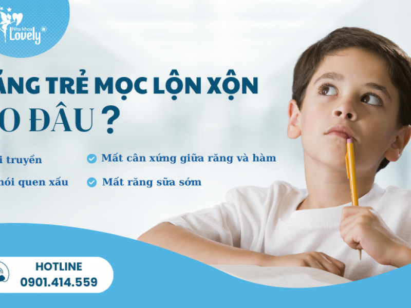 RĂNG TRẺ MỌC LỘN XỘN DO ĐÂU?